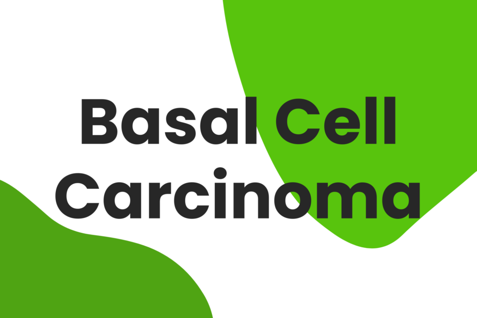 basal cell carcinoma